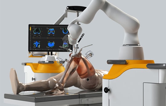 Robotic Knee surgery